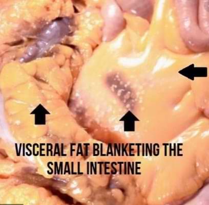 fat around intestines.
