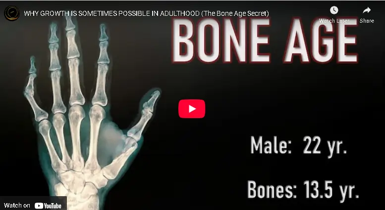 bone age explainer video